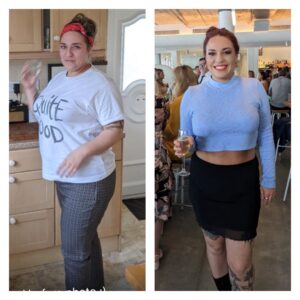 Laura, before and after medical weight loss treatment